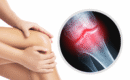 What Is Degenerative Joint Disease and How Is It Treated?