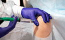 Joint Injections for Knee Pain Relief in San Antonio