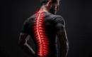 Types of Spinal Cord Stimulators