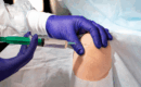 Common Conditions Treated with Joint Injections in San Antonio