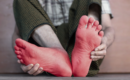 Neuropathic Pain After Road Accidents: Tingling, Burning, and Numbness