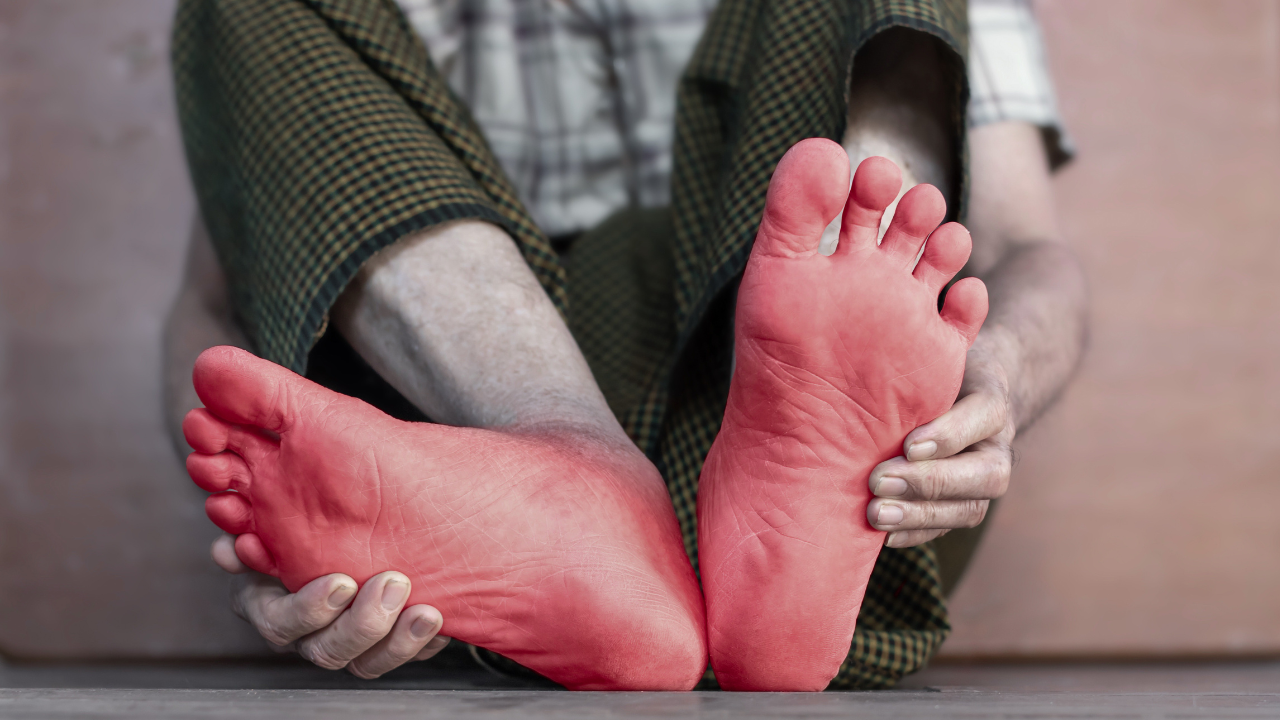 Neuropathic Pain After Road Accidents: Tingling, Burning, and Numbness