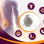 Benefits of Implantable Pain Pump Therapy