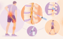 Can an Epidural Injection Help Pain That Shoots Down Your Leg