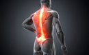 What are the different types of back pain